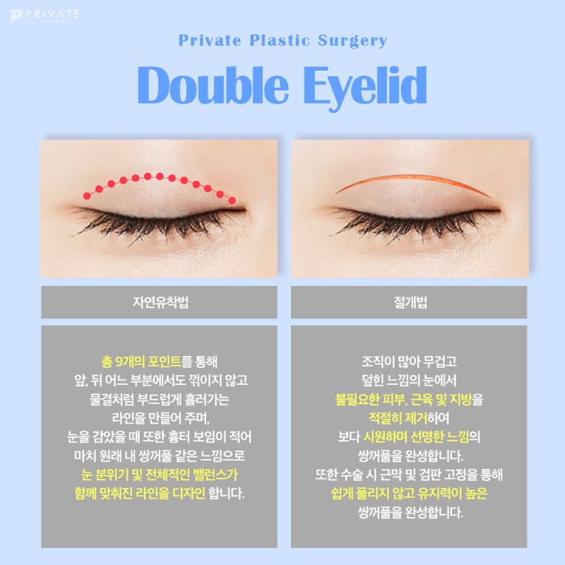 Tempat Terkenal untuk Operasi Mata Revisi adalah Private Plastic Surgery di Sinsa 사진 4