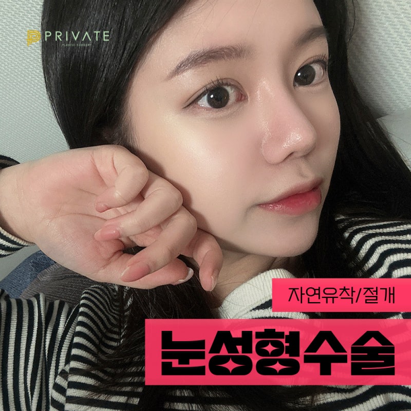 Tempat Terbaik untuk Operasi Kelopak Mata Ganda: Private Plastic Surgery di Sinsa 사진 2