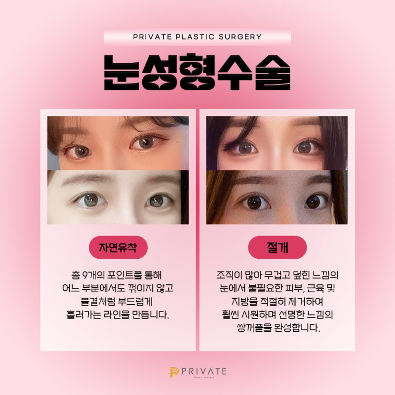 Tempat Terbaik untuk Operasi Kelopak Mata Ganda: Private Plastic Surgery di Sinsa