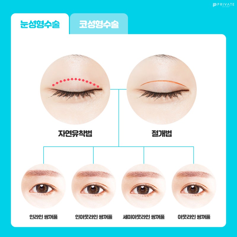 성형 수험생 이벤트는 여기, 프라이빗성형외과 사진 4