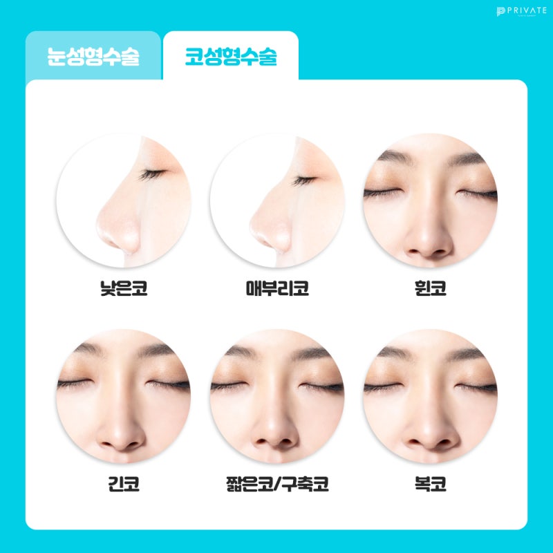 성형 수험생 이벤트는 여기, 프라이빗성형외과 사진 5