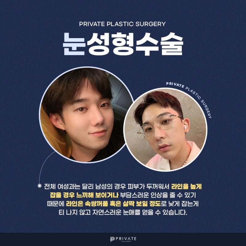 남자 쌍수 잘하는곳, 프라이빗성형외과