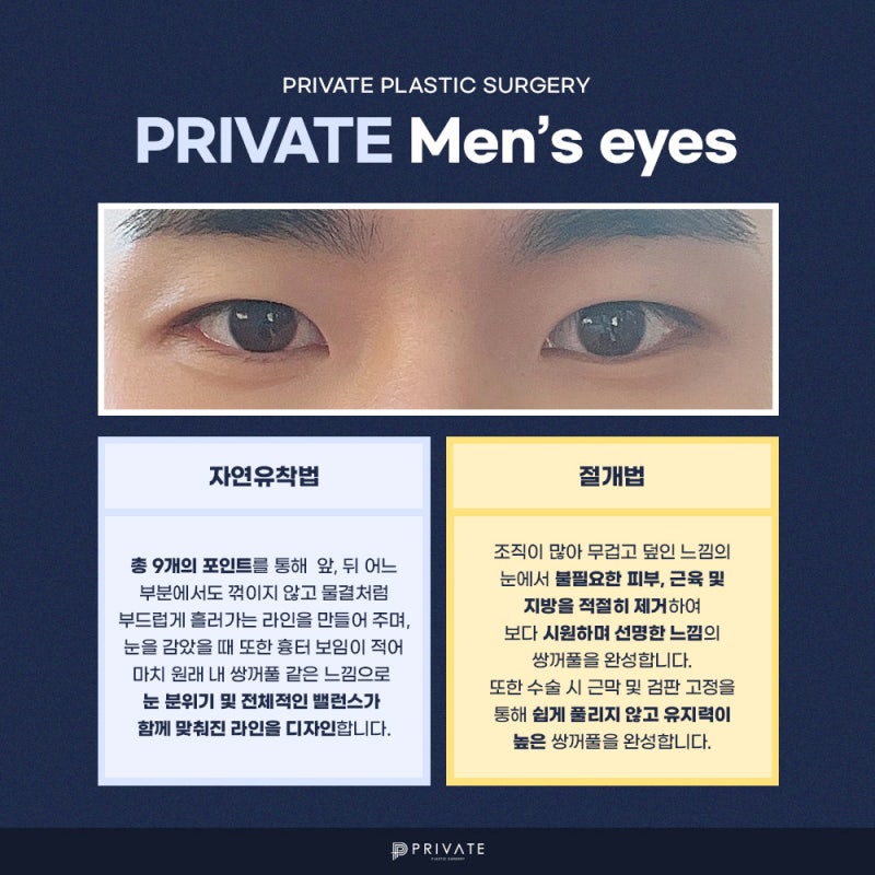 남자 쌍수 잘하는곳, 프라이빗성형외과 사진 4