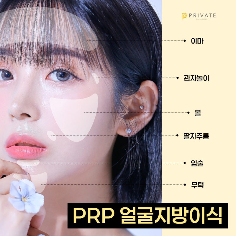 Transplantasi Lemak Wajah PRP di Private Plastic Surgery Sinsa Station 사진 5