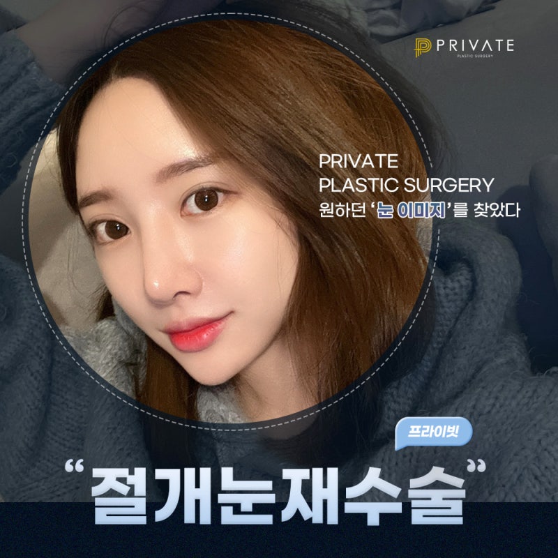 Mempelajari Metode Sayatan untuk Operasi Revisi Mata di Private Plastic Surgery 사진 2