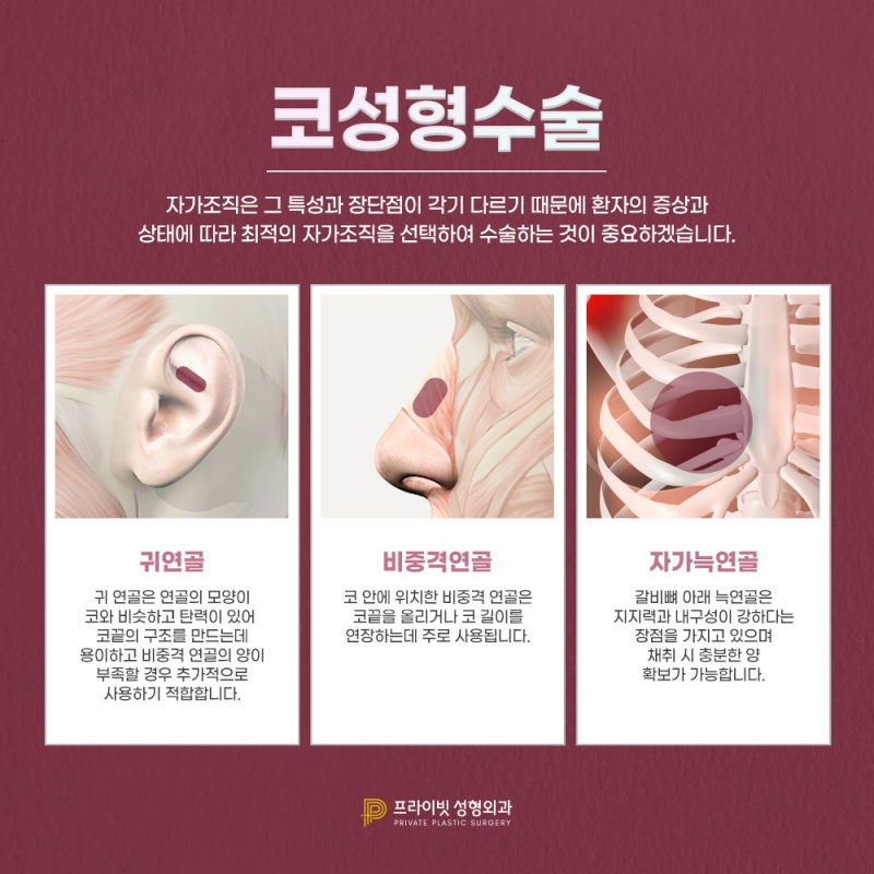 코성형외과유명한곳 찾고 있다면 신사 프라이빗성형외과 사진 5