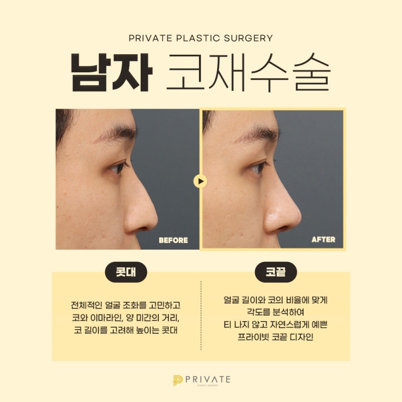 Tempat Terbaik untuk Operasi Revisi Hidung Pria, Private Plastic Surgery di Sinsa 사진 4