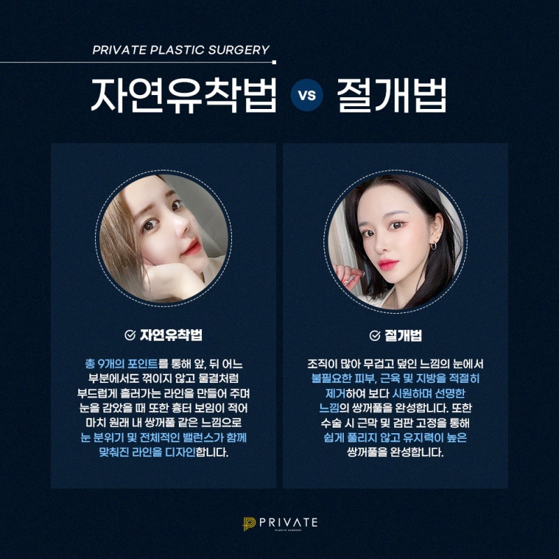 Operasi Ulang Sayatan Kelopak Mata Ganda di Sinsa Private Plastic Surgery 사진 4