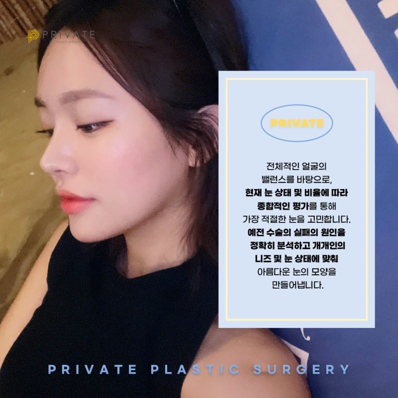 รีวิวศัลยกรรมตาสองชั้นแก้ไขที่ดีที่ Private Plastic Surgery