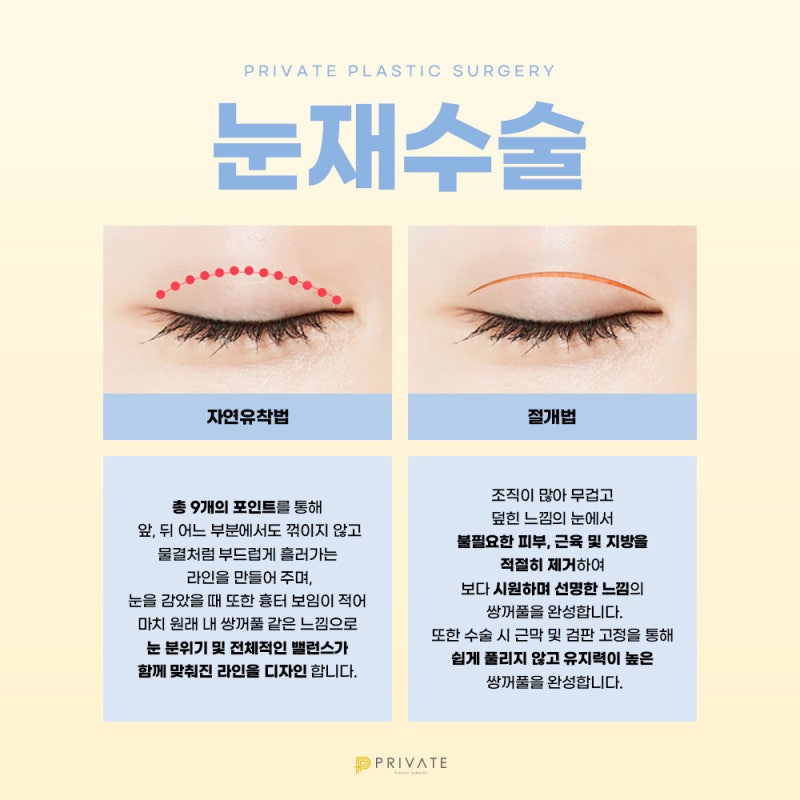 雙眼皮重修手術評價好的Private整形外科 사진 4