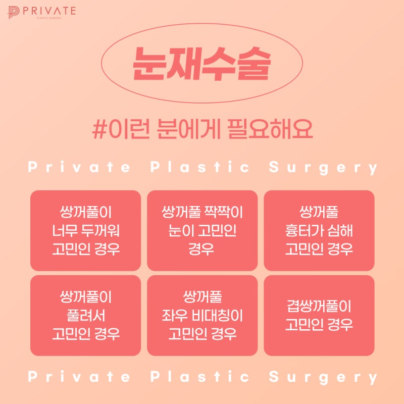 프라이빗성형외과 눈재수술 케이스 사진 4