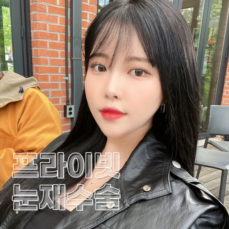 프라이빗성형외과 눈재수술 케이스 사진 6