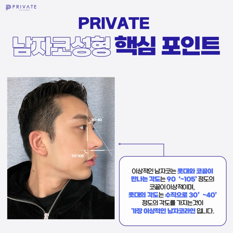 남성적인코라인 신사 남자코성형잘하는곳 사진 5