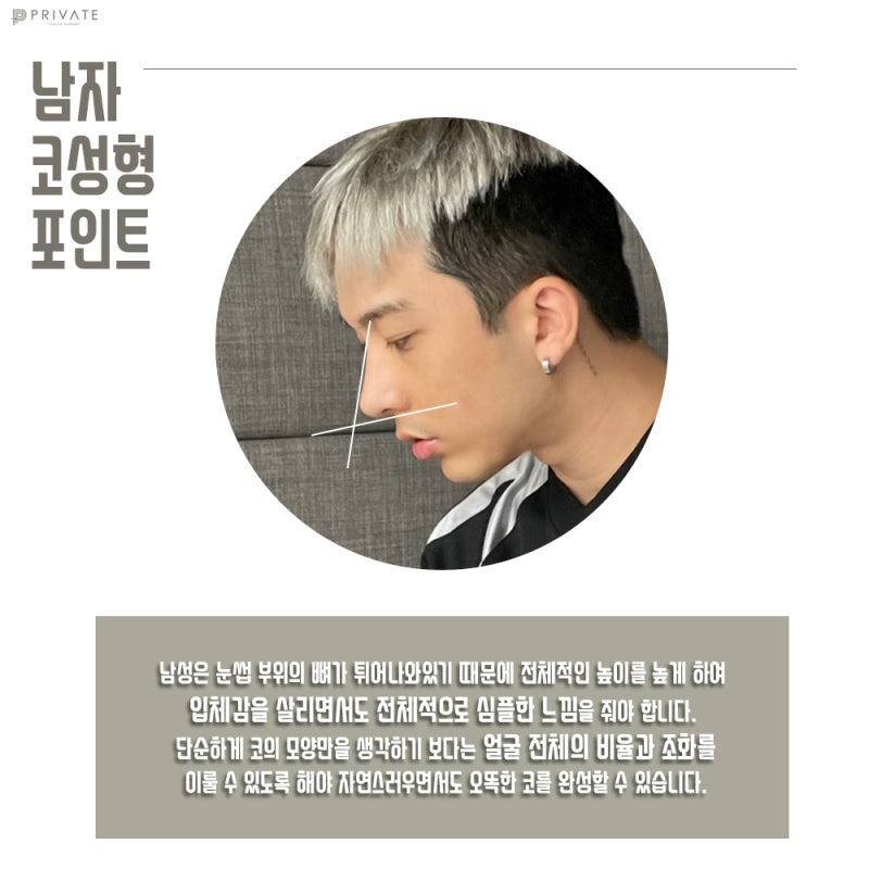 신사남자코성형수술 남자다운라인으로 세련되게