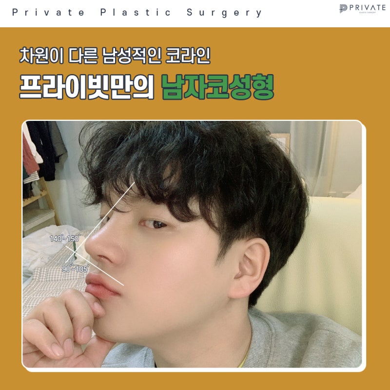 남자코성형수술의 이상적인 코라인은? 사진 5