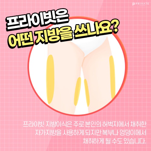 프라이빗성형외과풀페이스지방이식으로 동안얼굴시작 사진 5