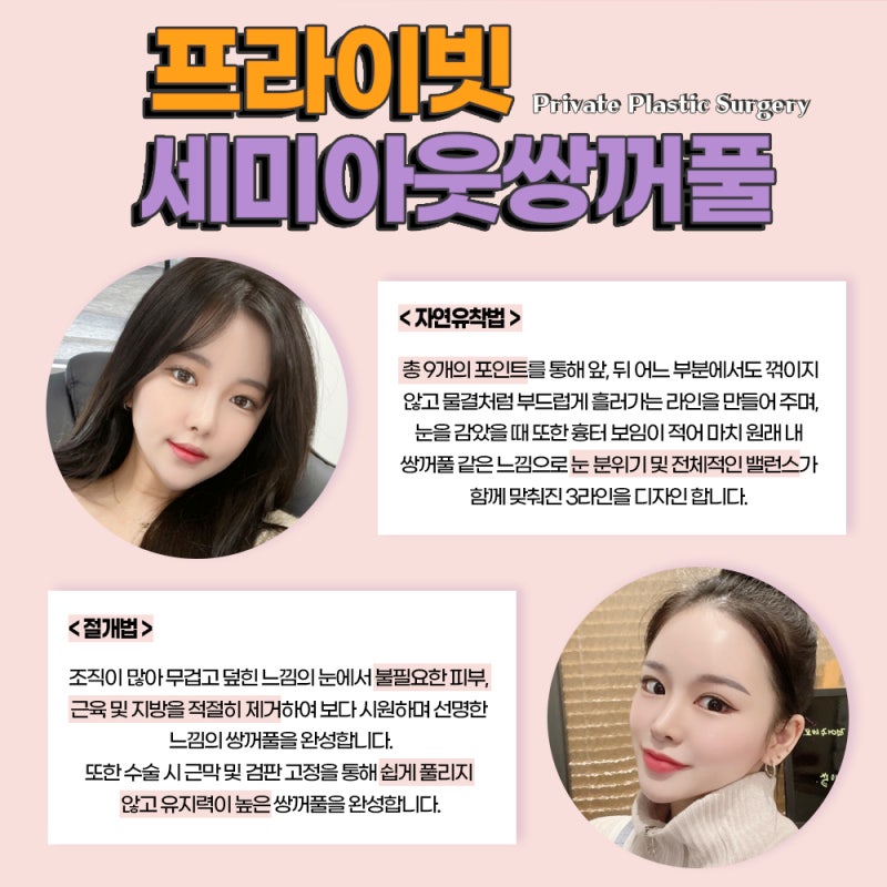 자려한 세미아웃라인잘하는곳 프라이빗성형외과 쌍수 사진 4