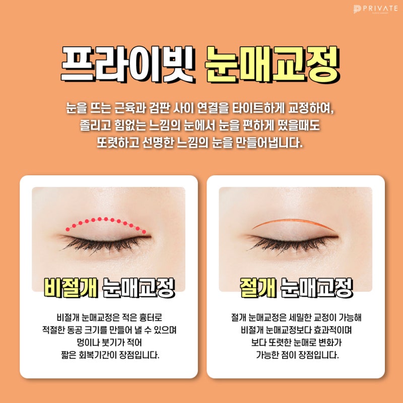 Tempat Terkenal untuk Operasi Koreksi Mata adalah Private Plastic Surgery
