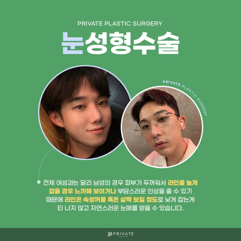 Operasi Mata Pria di Shinsa Private Plastic Surgery