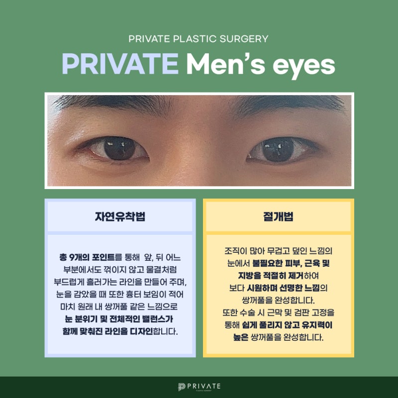 Operasi Mata Pria di Shinsa Private Plastic Surgery 사진 4
