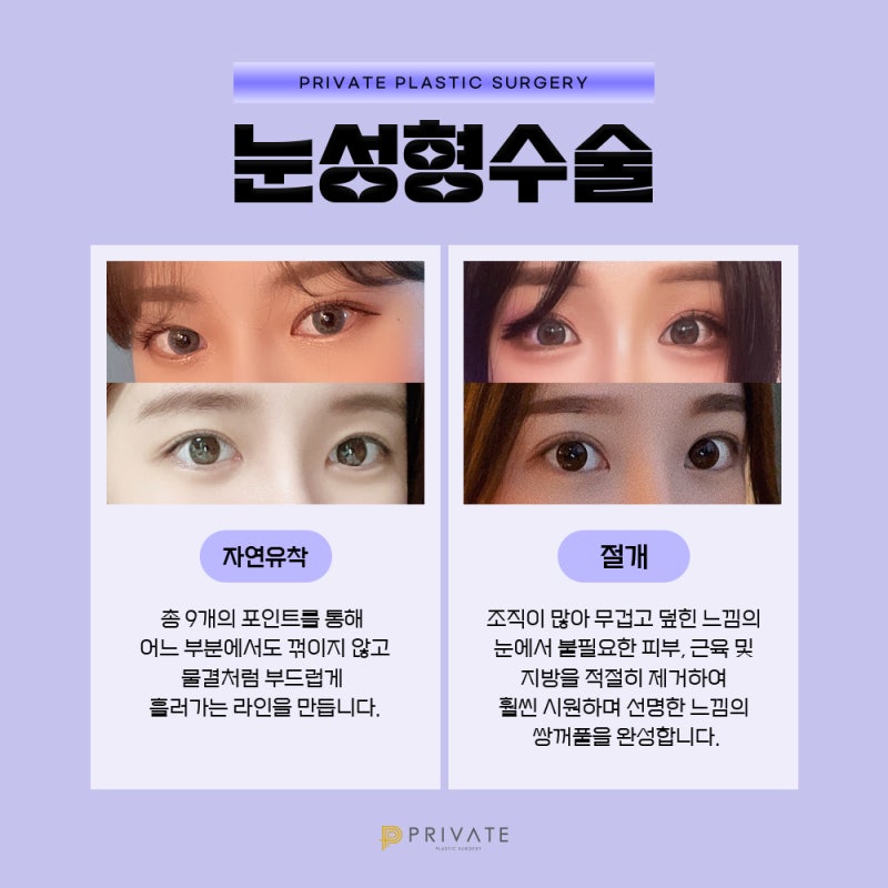 Operasi Mata Pertama yang Terpercaya, Private Plastic Surgery 사진 4