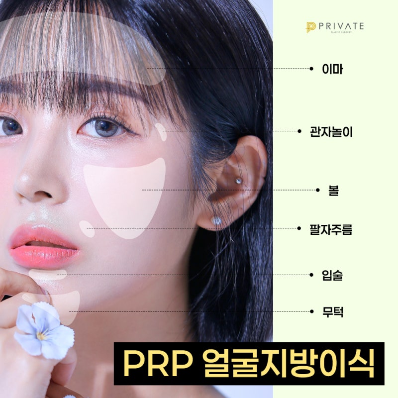 Efek transplantasi lemak PRP, cek di Private 사진 4