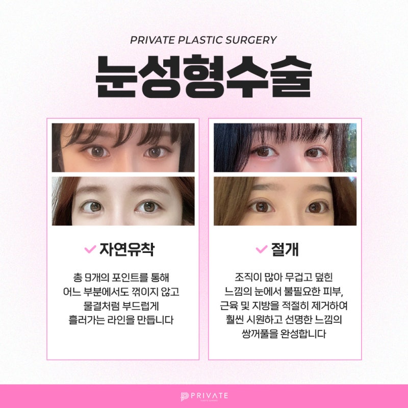 Tempat Terbaik untuk Operasi Kelopak Mata Ganda yang Indah: Private Plastic Surgery 사진 4