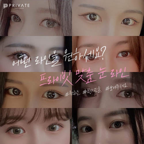 Tempat Terbaik untuk Operasi Kelopak Mata Ganda yang Indah: Private Plastic Surgery 사진 6