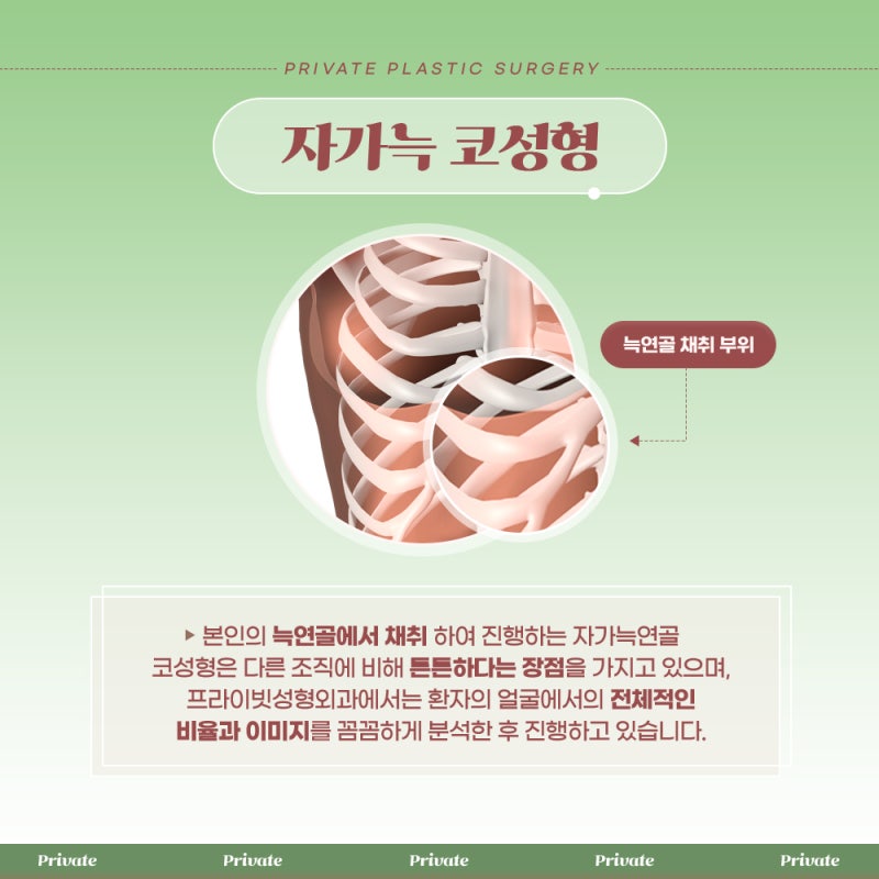 자가늑코성형 라인 예쁜곳 프라이빗성형외과