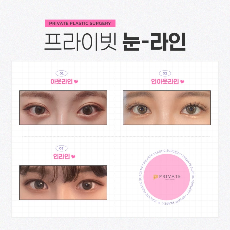 프라이빗성형외과 눈재수술 유명한곳 사진 4