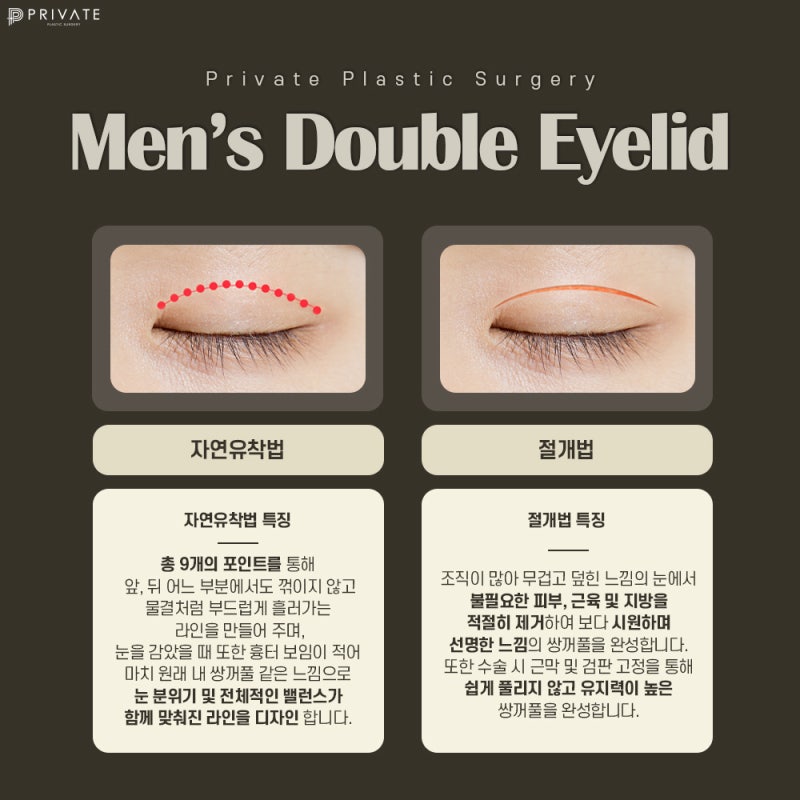 남자 쌍수 절개 수술은 프라이빗성형외과 사진 4