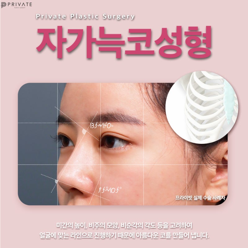 Jika Anda mempertimbangkan operasi hidung dengan tulang rawan iga autologus, Private Plastic Surgery