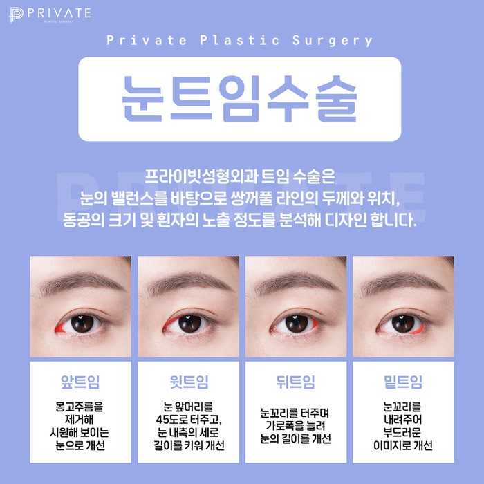 Tempat Terbaik untuk Operasi Mata Terbuka di Sinsa: Private Plastic Surgery Clinic
