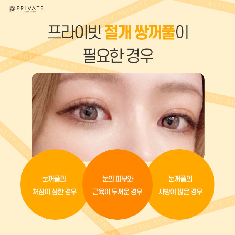 Private Plastic Surgery Clinic dengan Ulasan Sayatan Kelopak Mata Ganda yang Baik 사진 5