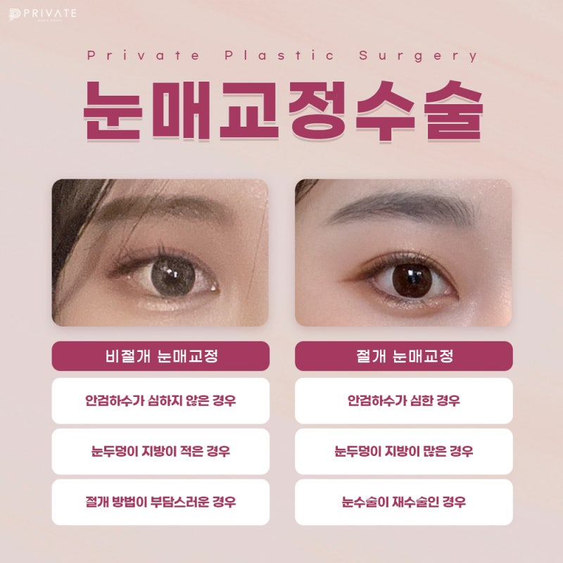 Private Plastic Surgery Clinic: Eyelid Correction and Double Eyelid Surgery 사진 6