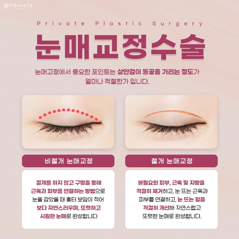 Private Plastic Surgery Clinic: Eyelid Correction and Double Eyelid Surgery 사진 5