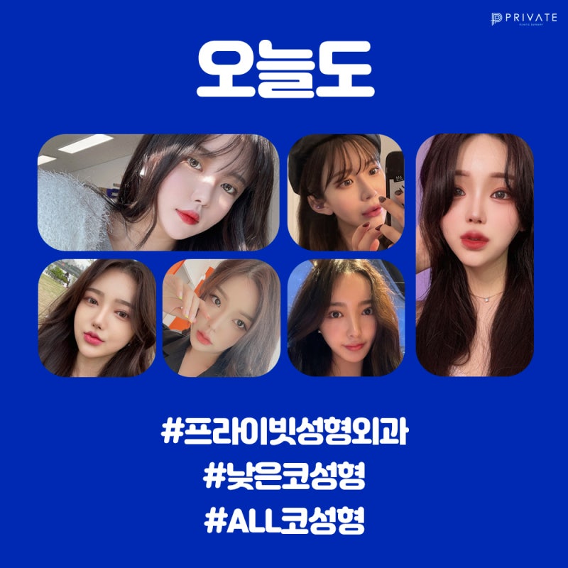 낮은코성형후기 볼 수 있는 프라이빗성형외과 사진 7