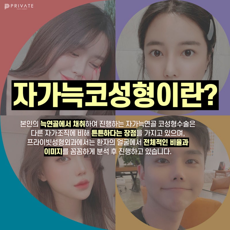 Mengenal Operasi Rhinoplasty Tulang Rawan Rusuk Autologus di Private Plastic Surgery