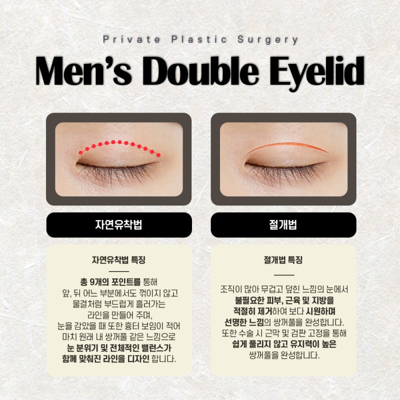 프라이빗성형외과 남자눈성형수술 사진 4
