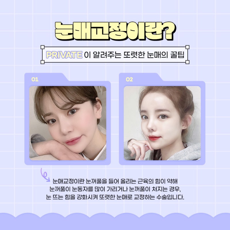 Operasi Mata Ganda Koreksi Mata di Private Plastic Surgery Clinic dengan Tingkat Kepuasan Tinggi
