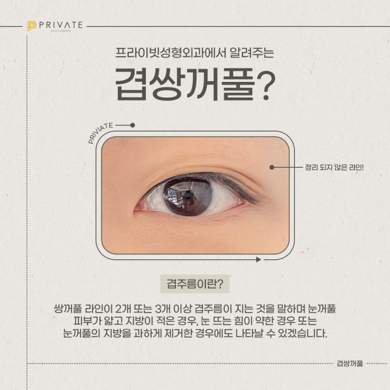Operasi Kelopak Mata Ganda di Private Plastic Surgery
