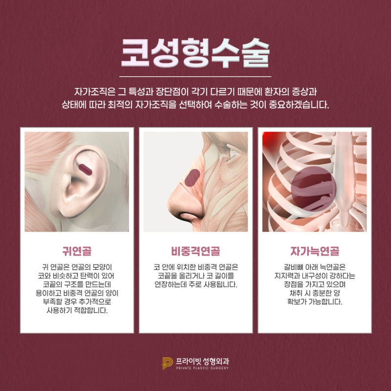 Ulasan Operasi Hidung Rendah Terbaik, Klinik Bedah Plastik Private di Sinsa 사진 4