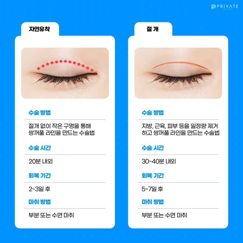 了解Private整形外科的雙眼皮切開術