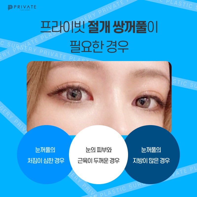 了解Private整形外科的雙眼皮切開術 사진 5