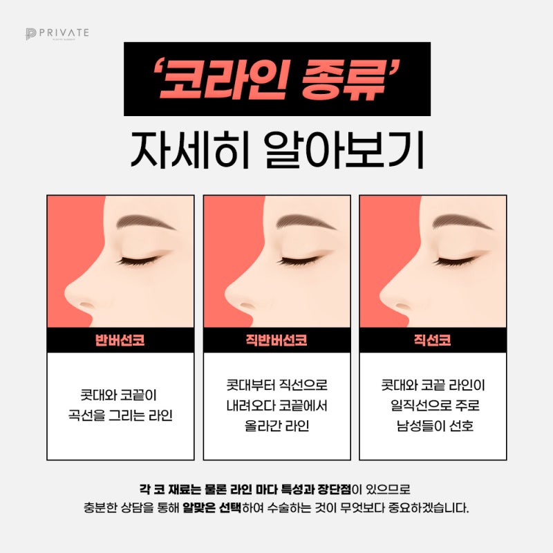 화살코성형후기가 좋은 프라이빗성형외과 사진 4