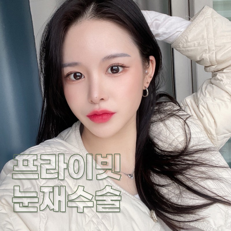 소세지눈 재수술 후기가 좋은 프라이빗성형외과 사진 7