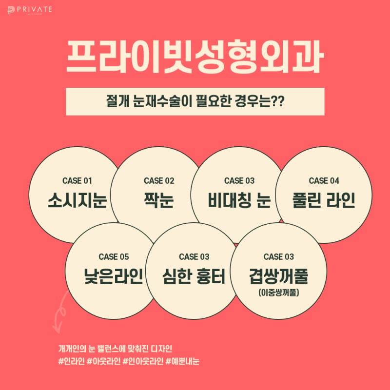 눈재수술유명한곳 신사 프라이빗성형외과 사진 4