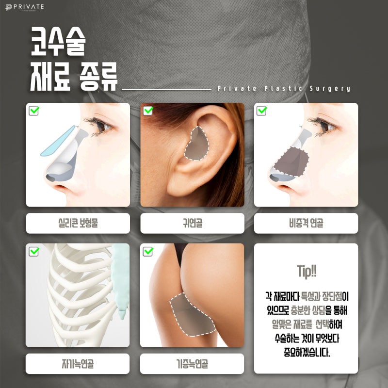 Ulasan Bagus tentang Operasi Hidung Pria Sebelum dan Sesudah di Private Plastic Surgery 사진 5