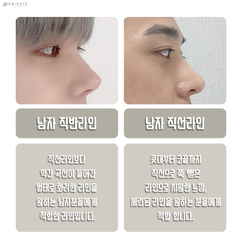 Ulasan Bagus tentang Operasi Hidung Pria Sebelum dan Sesudah di Private Plastic Surgery 사진 4