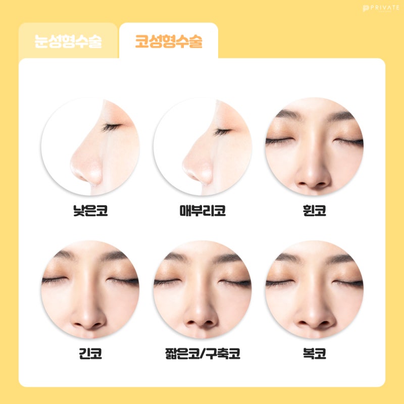 Acara Ujian Masuk Perguruan Tinggi, Private Plastic Surgery 사진 5